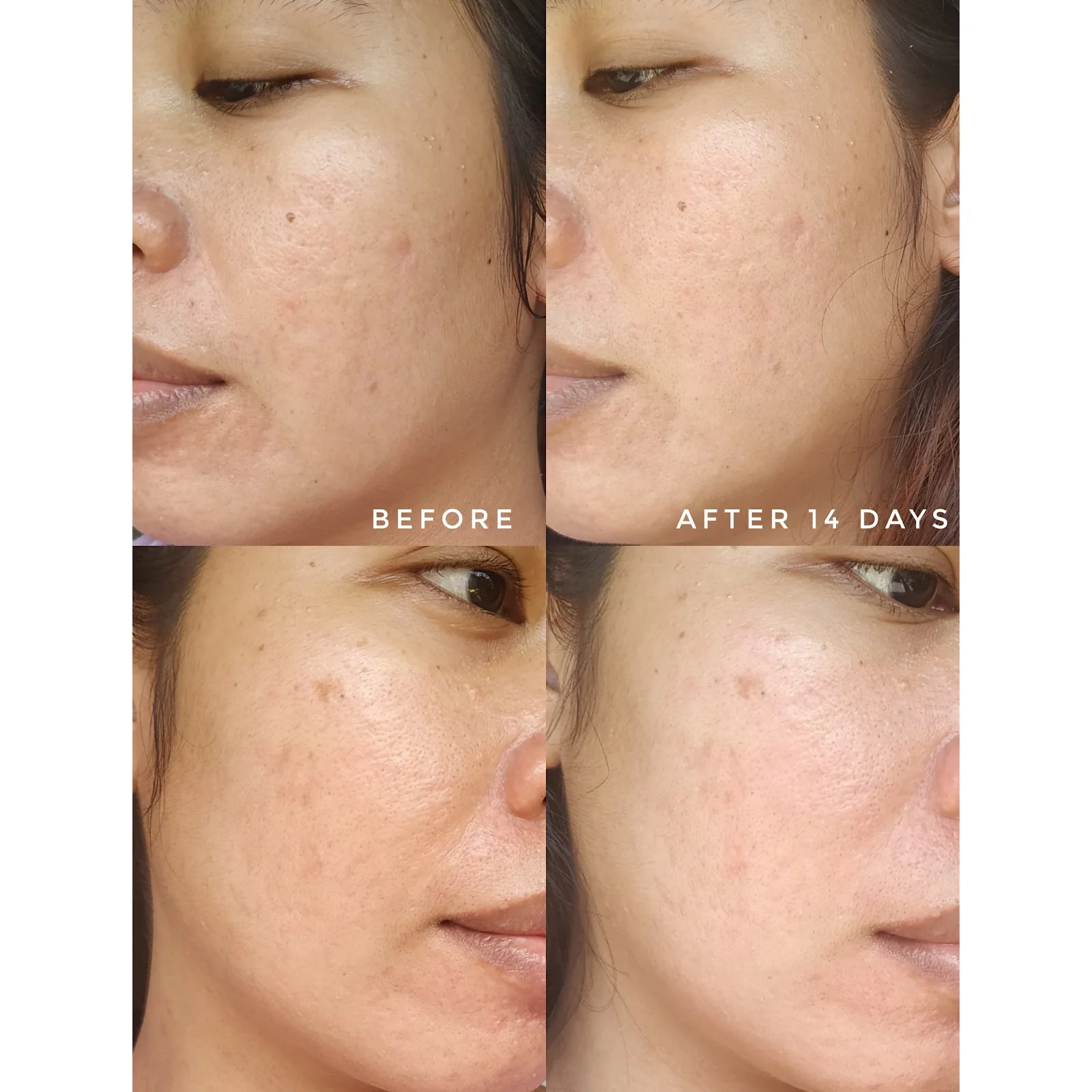 AXIS-Y VEGAN DAILY PURIFYING TREATMENT TONER 200ML - Image 3