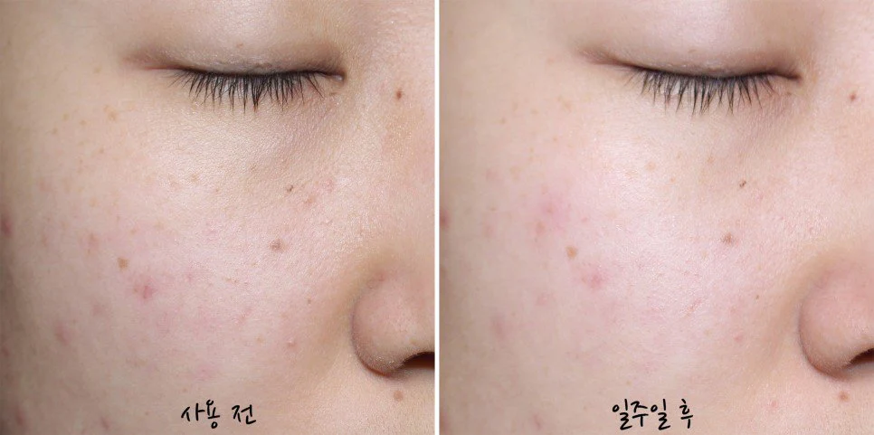 [Dr. Jart+] Cicapair Calming Mask 5ea - Image 3