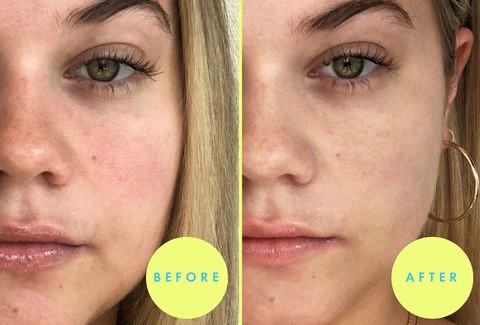 [Dr. Jart+] Cicapair Calming Mask 5ea - Image 4