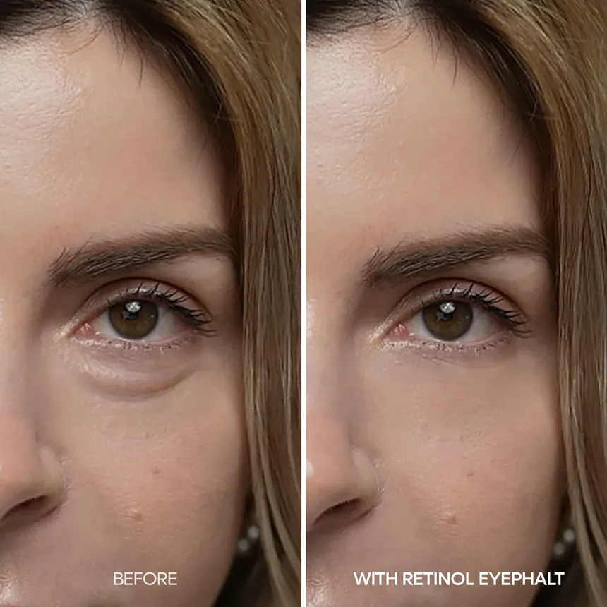 [Dr.Melaxin] Eyephalt Retinol Eyebag Cream 10g - Image 4