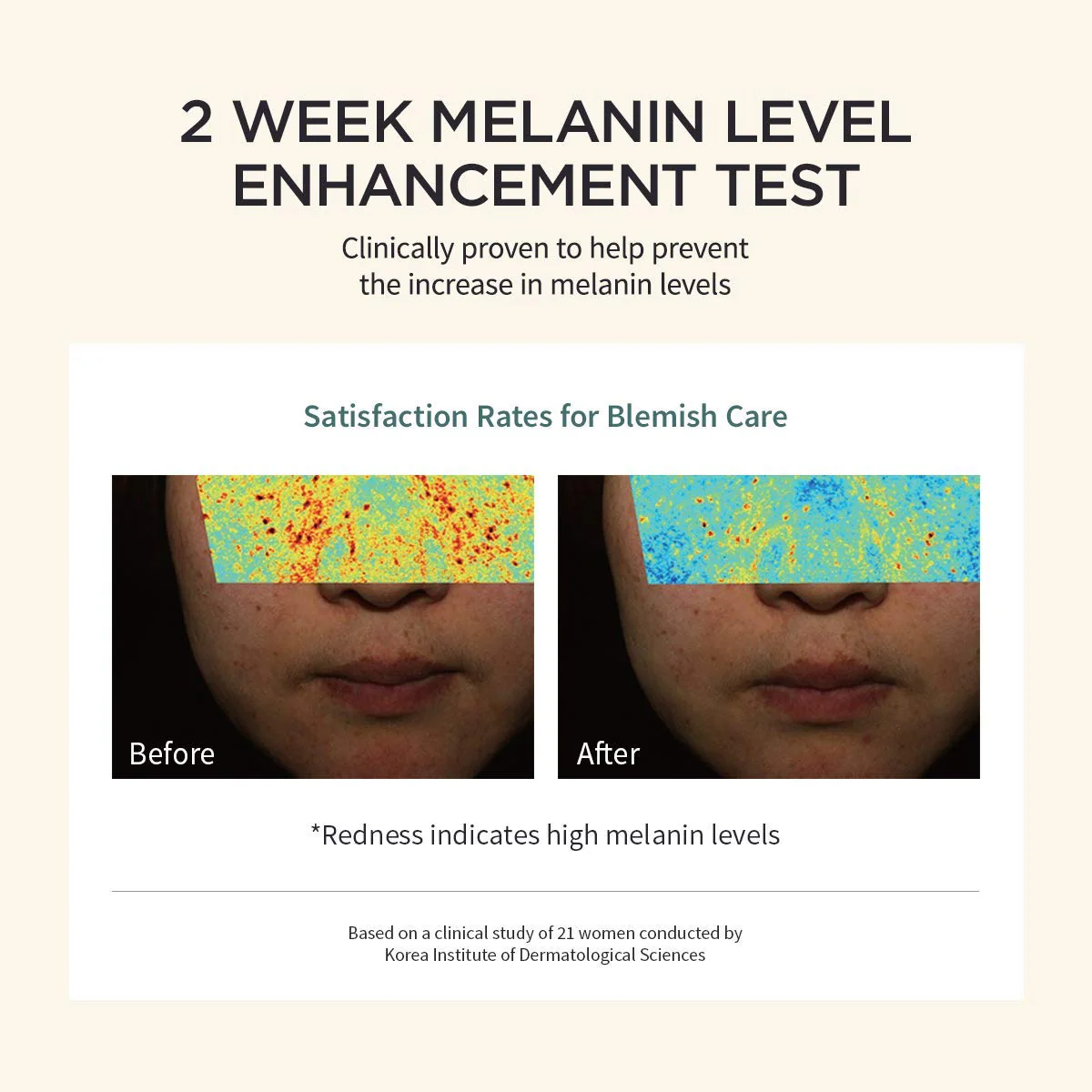 [Goodal] Green Tangerine Vita C Dark Spot Serum 40ml - Image 3