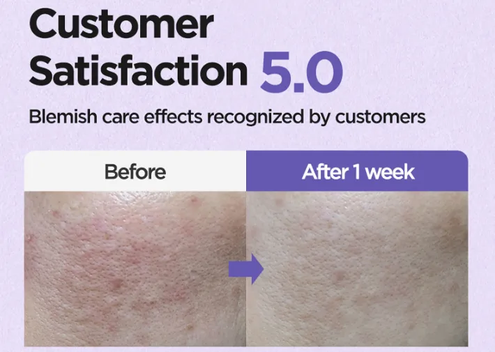 [Isntree] Onion Newpaid Clear Pad (60ct) - Image 3